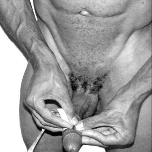 penismeting vóór vergroting